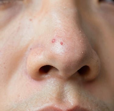 A young woman with freckles on her face