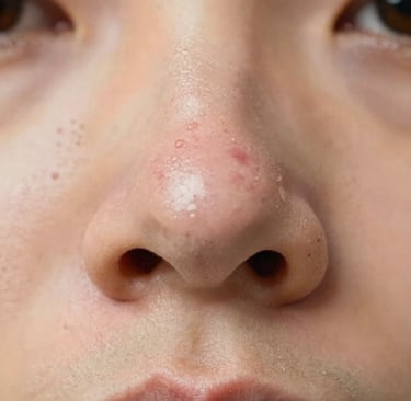 A young woman with freckles on her face