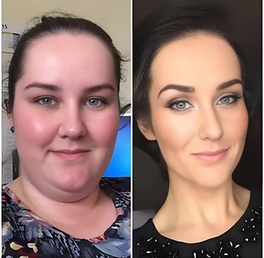 Welke Voordelen Bieden Ozem Patches?