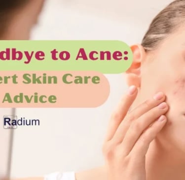 goodbye to acne
