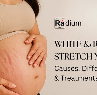 white & red stretch marks