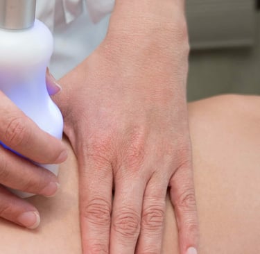 Cryolipolyse élimination des adipocytes par le froid