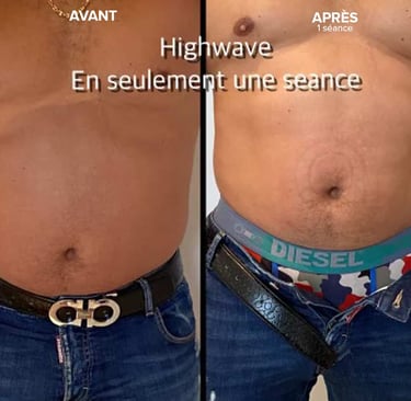 avant apres
