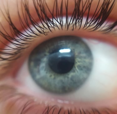 Thérapie EMDR sur Le Morbihan