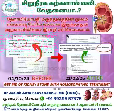 Kidney stone Homeopathic medicine
