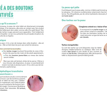 Extrait de mon livre. Mon bébé à des boutons 