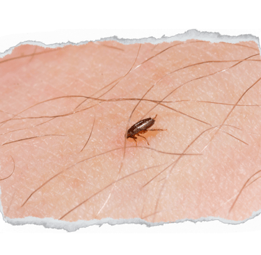 como acabar com as pulgas