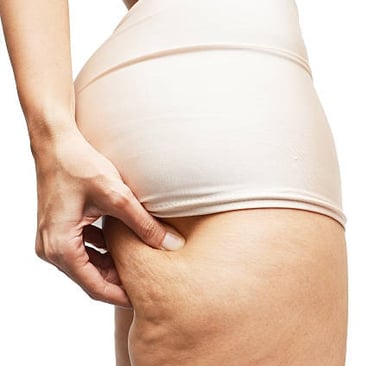 cellulite éliminer coach sportif amiens