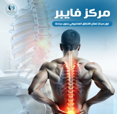 علاج الانزلاق الغضروفي بدون جراحة