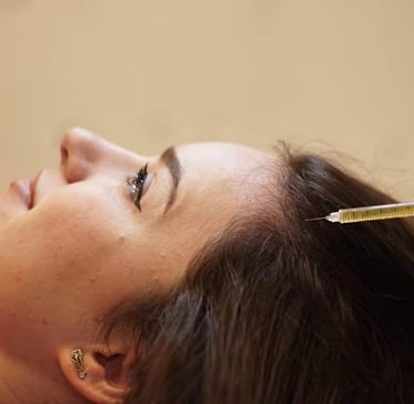 female hair transplant Algeria, male pattern baldness treatment, beard transplant, clinique turque