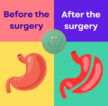 before and after a gastric sleeve