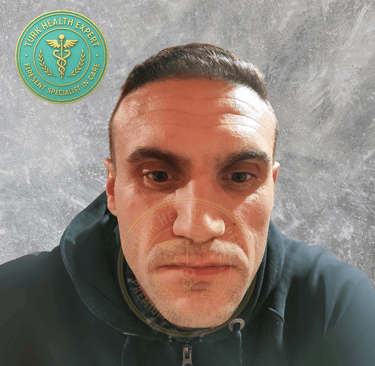 Pompiers SDIS 13 9 mois apres la greffe de cheveux