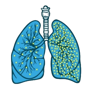 Illustration des poumons montrant les niveaux de molécules d'oxygène avant et après oxygénothérapie