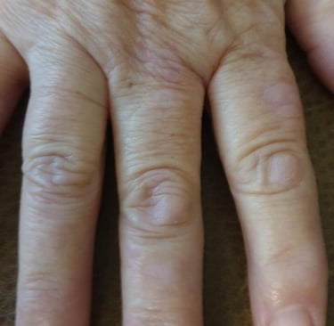 Close-up of an elderly person's hand showing skin texture, age spots, and wrinkles.