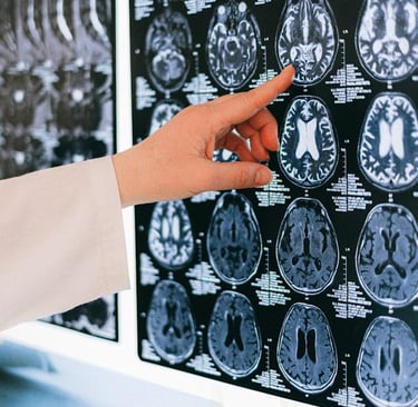 cerebro exitoso