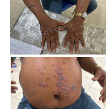 foto de uma pessoa doente