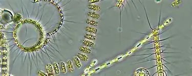 Microscopic view of Chaetoceros marine diatoms and phytoplankton chains in green water.
