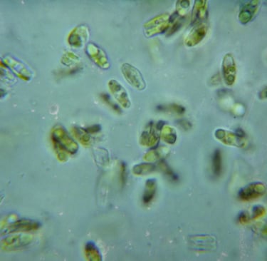 Microscopic view of green diatom algae cells clustered in a liquid sample.