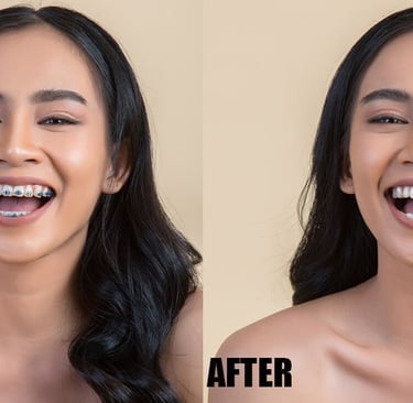 brace-removal