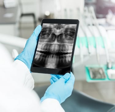 Implantologia dentale