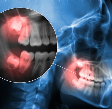 Close-up of a patient receiving dental examination for a painful toothache