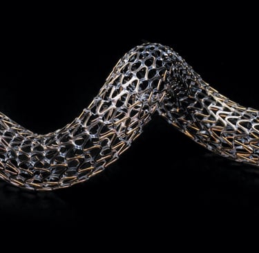 Vascular surgery artery stent by dr omar hamdallah