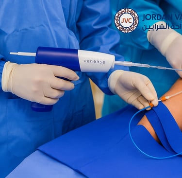 venaseal procedure Amman Jordan