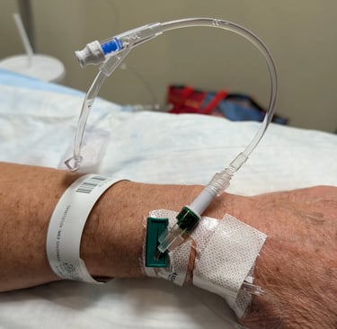 IV port placed in Greg Rowland's wrist