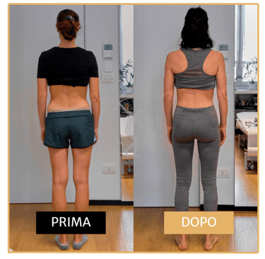Risoluzione lombalgia cronica post-cesareo donna di 40 anni Performa Specialists by Dott. Rossin