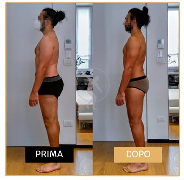 Risoluzione lombalgia cronica uomo di 40 anni Performa Specialists by Dott. Alessandro Rossin