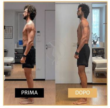 Miglioramento posturale in uomo di 40 anni Performa Specialists By Dott. Alessandro Rossin
