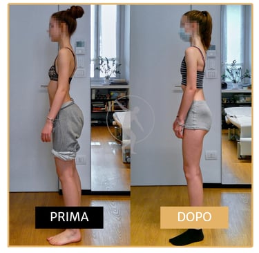Miglioramento posturale ragazza di 17 anni Performa Specialists by Dott. Rossin