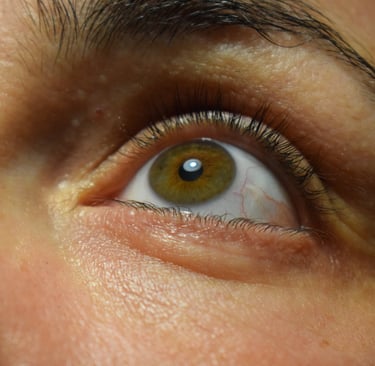 Green eye
