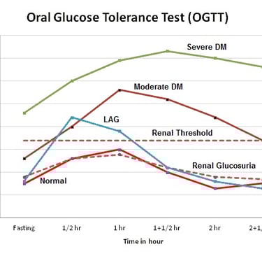 GTT curves