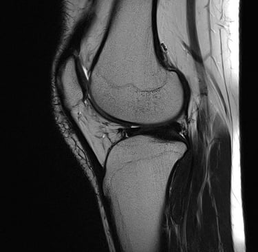 Knee MRI