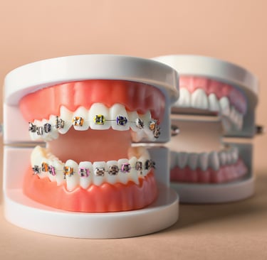 زراعة الأسنان - عيادة طب الاسنان دكتور وسام علي العباسي