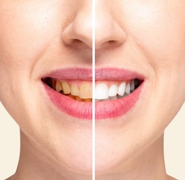 زراعة الأسنان - عيادة طب الاسنان دكتور وسام علي العباسي