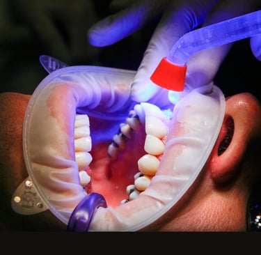 زراعة الأسنان - عيادة طب الاسنان دكتور وسام علي العباسي