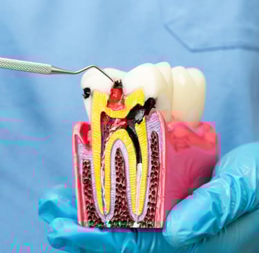 زراعة الأسنان - عيادة طب الاسنان دكتور وسام علي العباسي