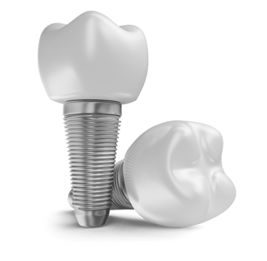 Implante dentário em São Mateus do Sul