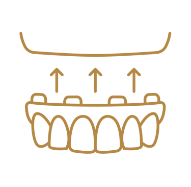 Prótese protocolo em São Mateus do Sul na clínica GT odontologia