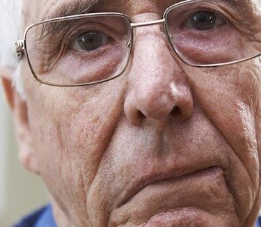 El Cannabis medicinal es efectivo para tratar la parálisis de Bell