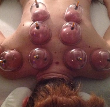 massage cupping