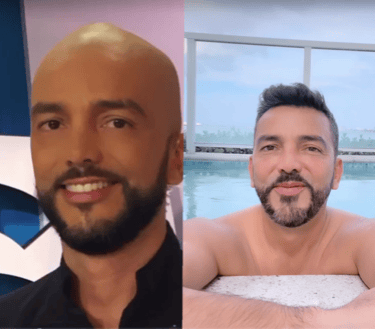 hombre calvo y hombre con cabello