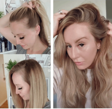 antes y después de mujer con entradas