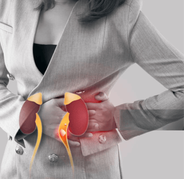 Kidney Stone best surgeon in ballia