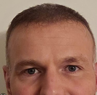 a man after his anti wrinkle treatment