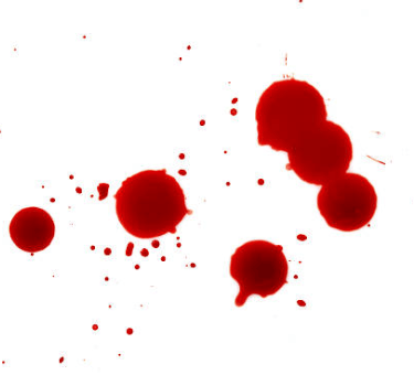 Cédric maynadié, hypnose dans le gard. préparation à la chirurgie. gerer les phobies du sang