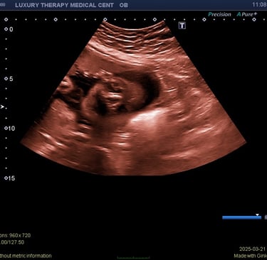 Complete OB Ultrasound in hialeah