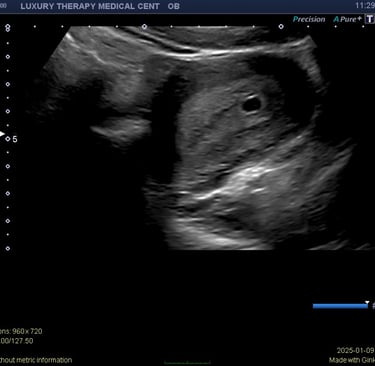 Pregnancy Ultrasound in Hialeah